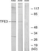 Anti-TFE3 antibody produced in rabbit affinity isolated antibody