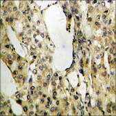 Anti-phospho-SYK (pTyr525) antibody produced in rabbit affinity isolated antibody