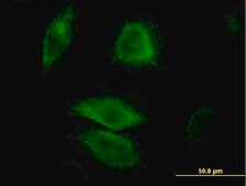 Monoclonal Anti-DUSP6 antibody produced in mouse clone 3G2, purified immunoglobulin, buffered aqueous solution