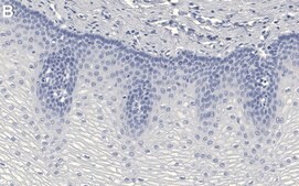 Anti-Rac1 Antibody, clone 1E9 ZooMAb® Rabbit Monoclonal recombinant, expressed in HEK 293 cells