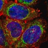 Anti-PHB antibody produced in rabbit Prestige Antibodies® Powered by Atlas Antibodies, affinity isolated antibody, buffered aqueous glycerol solution