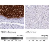 Anti-A2ML1 antibody produced in rabbit Prestige Antibodies® Powered by Atlas Antibodies, affinity isolated antibody, buffered aqueous glycerol solution