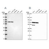 Anti-PAK4 antibody produced in rabbit Prestige Antibodies® Powered by Atlas Antibodies, affinity isolated antibody