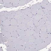 Anti-CCL27 Prestige Antibodies® Powered by Atlas Antibodies, affinity isolated antibody