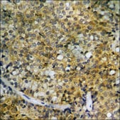 Anti-phospho-HDAC5 (pSer259) antibody produced in rabbit affinity isolated antibody