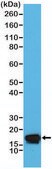 Anti-Stathmin (CTMN1) antibody, Rabbit monoclonal recombinant, expressed in HEK 293 cells, clone RM350, purified immunoglobulin