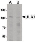 Anti-ULK1 antibody produced in rabbit affinity isolated antibody
