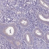 Anti-SPTBN2 antibody produced in rabbit Prestige Antibodies® Powered by Atlas Antibodies, affinity isolated antibody, buffered aqueous glycerol solution