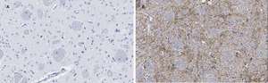 Anti-Tyrosine Hydroxylase Antibody, clone 3M12, ZooMAb® Rabbit Monoclonal recombinant, expressed in HEK 293 cells