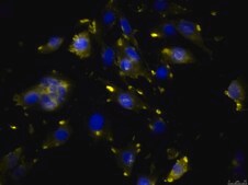 OSUMMER.8 Mouse NRAS-Mutant Melanoma Cell Line