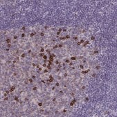 Anti-CD38 antibody produced in rabbit Prestige Antibodies® Powered by Atlas Antibodies, affinity isolated antibody, buffered aqueous glycerol solution