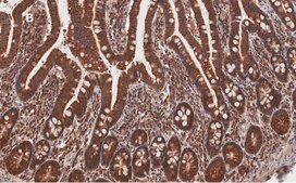 Anti-AMPK alpha Antibody, clone 2D22, ZooMAb® Rabbit Monoclonal recombinant, expressed in HEK 293 cells