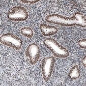 Monoclonal Anti-SETD2 antibody produced in mouse Prestige Antibodies® Powered by Atlas Antibodies, clone CL9956, purified immunoglobulin, buffered aqueous glycerol solution