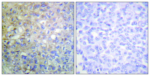 Anti-FGFR1 antibody produced in rabbit affinity isolated antibody