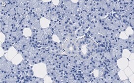 Anti-Aquaporin 5 Antibody, clone 3H17 ZooMAb® Rabbit Monoclonal recombinant, expressed in HEK 293 cells