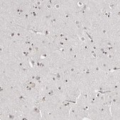 Anti-TRIM66 antibody produced in rabbit Prestige Antibodies® Powered by Atlas Antibodies, affinity isolated antibody, buffered aqueous glycerol solution