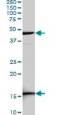 Monoclonal Anti-LEF1 antibody produced in mouse clone 5A3, purified immunoglobulin, buffered aqueous solution