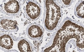 Anti-GAPDH Antibody, clone 10B13, ZooMAb® Rabbit Monoclonal recombinant, expressed in HEK 293 cells