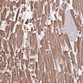 Anti-MYL2 antibody produced in rabbit Prestige Antibodies® Powered by Atlas Antibodies, affinity isolated antibody, buffered aqueous glycerol solution