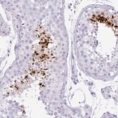 Anti-TNP1 antibody produced in rabbit Prestige Antibodies® Powered by Atlas Antibodies, affinity isolated antibody, buffered aqueous glycerol solution