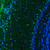 Anti-PPP1R1B antibody produced in rabbit Prestige Antibodies® Powered by Atlas Antibodies, affinity isolated antibody, buffered aqueous glycerol solution