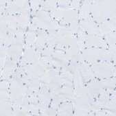 Anti-RYR2 antibody produced in rabbit Prestige Antibodies® Powered by Atlas Antibodies, affinity isolated antibody, buffered aqueous glycerol solution