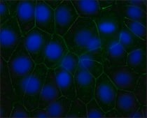 Monoclonal Anti-Pan Cadherin antibody produced in mouse clone CH-19, ascites fluid