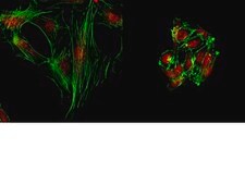 抗-JMJD3（NT）抗体 from rabbit
