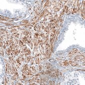 Anti-THY1 antibody produced in rabbit Prestige Antibodies® Powered by Atlas Antibodies, affinity isolated antibody, buffered aqueous glycerol solution