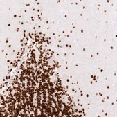 Monoclonal Anti-H2AFY antibody produced in mouse Prestige Antibodies® Powered by Atlas Antibodies, clone CL5245, purified immunoglobulin, buffered aqueous glycerol solution