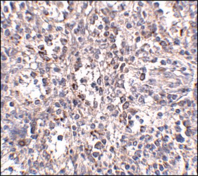 Anti-SCARB1 antibody produced in rabbit affinity isolated antibody, buffered aqueous solution