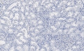 Anti-ULK2 Antibody, clone 3E19 ZooMAb® Rabbit Monoclonal recombinant, expressed in HEK 293 cells