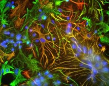 抗-波形蛋白抗体 serum, Chemicon®