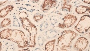 Anti-Angiotensin Converting Enzyme Antibody, clone 9B9 clone 9B9, Chemicon®, from mouse