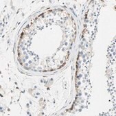 Anti-ATF6 antibody produced in rabbit Prestige Antibodies® Powered by Atlas Antibodies, affinity isolated antibody, buffered aqueous glycerol solution
