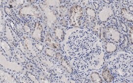 Anti-c-Myc Antibody, clone 7E18, ZooMAb® Rabbit Monoclonal recombinant, expressed in HEK 293 cells