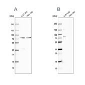 Anti-OPTN antibody produced in rabbit Ab2, Prestige Antibodies® Powered by Atlas Antibodies, affinity isolated antibody, buffered aqueous glycerol solution