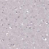 Anti-CD28 antibody produced in rabbit Prestige Antibodies® Powered by Atlas Antibodies, affinity isolated antibody
