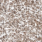 Monoclonal Anti-PIK3CA antibody produced in mouse Prestige Antibodies® Powered by Atlas Antibodies, clone CL8347, purified immunoglobulin, buffered aqueous glycerol solution