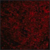 Anti-Presenilin1 antibody produced in rabbit affinity isolated antibody, buffered aqueous solution