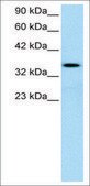 Anti-LEF1 (AB1) antibody produced in rabbit affinity isolated antibody