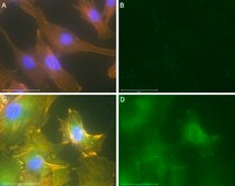 Anti-p-Paxillin-Tyr118 Antibody, clone 1E19 ZooMAb® Rabbit Monoclonal recombinant, expressed in HEK 293 cells