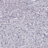 Anti-QPCT antibody produced in rabbit Prestige Antibodies® Powered by Atlas Antibodies, affinity isolated antibody, buffered aqueous glycerol solution