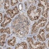 抗 LAMP1 兔抗 Prestige Antibodies® Powered by Atlas Antibodies, affinity isolated antibody, buffered aqueous glycerol solution