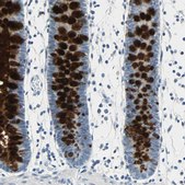 Anti-MUC4 antibody produced in rabbit Prestige Antibodies® Powered by Atlas Antibodies, affinity isolated antibody, buffered aqueous glycerol solution