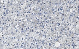 Anti-Flotillin 1 Antibody, clone 1F12-L1 ZooMAb® Rabbit Monoclonal recombinant, expressed in HEK 293 cells
