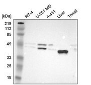 Anti-PON1 antibody produced in rabbit Prestige Antibodies® Powered by Atlas Antibodies, affinity isolated antibody, buffered aqueous glycerol solution