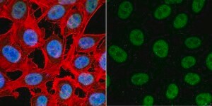 Anti-TATA-Binding-Protein Antibody ascites fluid, Chemicon®