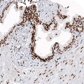 Monoclonal Anti-H2AFY antibody produced in mouse Prestige Antibodies® Powered by Atlas Antibodies, clone CL5256, purified immunoglobulin, buffered aqueous glycerol solution