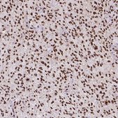 Monoclonal Anti-ATRX antibody produced in mouse Prestige Antibodies® Powered by Atlas Antibodies, clone CL0537, purified immunoglobulin, buffered aqueous glycerol solution